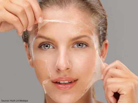 Comment le masque hydrojelly transforme votre soin peeling visage ?